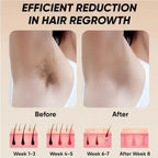 Laser epilator hair removal before and after armpit results with visible hair reduction by week 8