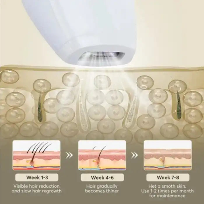 Laser epilator hair removal reduces hair thickness and growth across 8-week treatment cycle