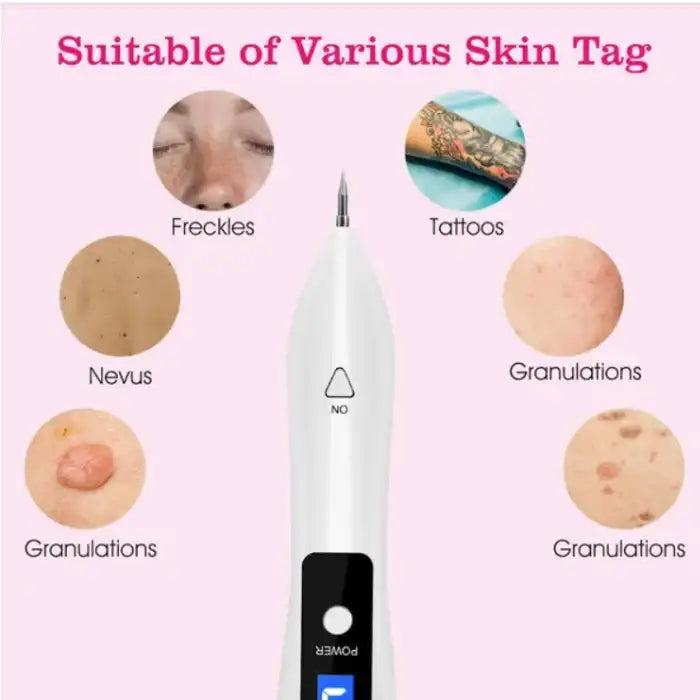Skin Tag Remover suitable for freckles, tattoos, nevus, and various types of skin tags.