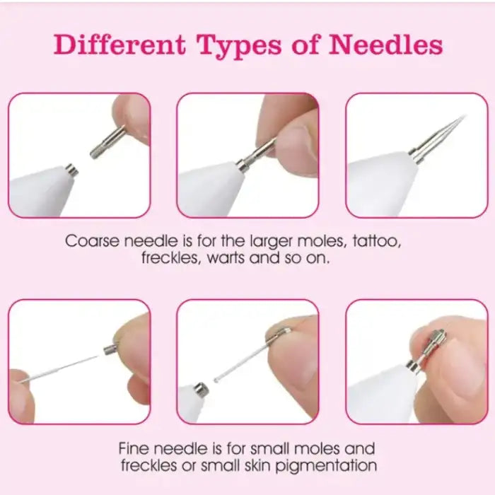Skin Tag Remover showing different needle types for treating large and small skin imperfections.